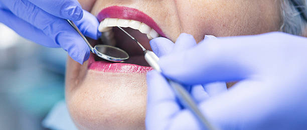 Best Emergency Treatment for Dental Infections or Abscesses in Bonifay, FL